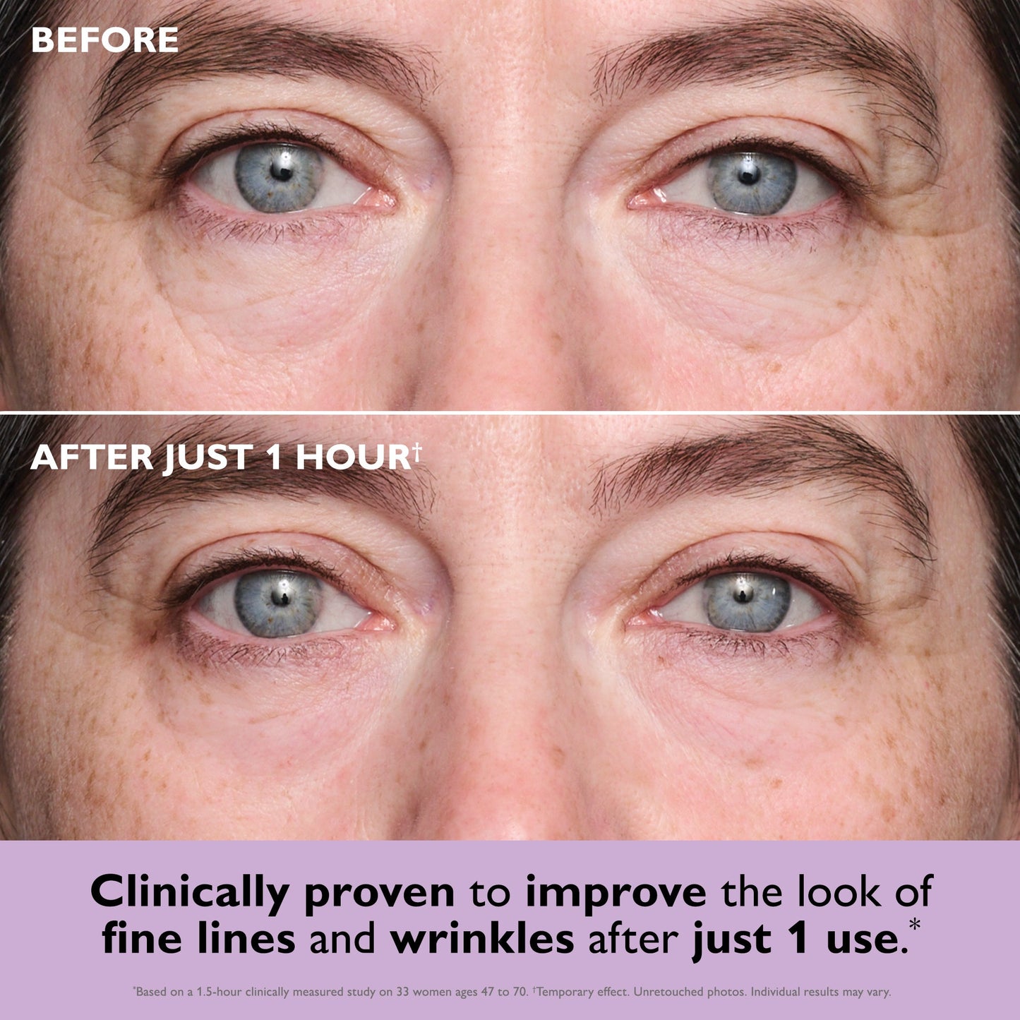 Sofortige straffende Augenklappen mit Collagen-Infusion von Rianmond