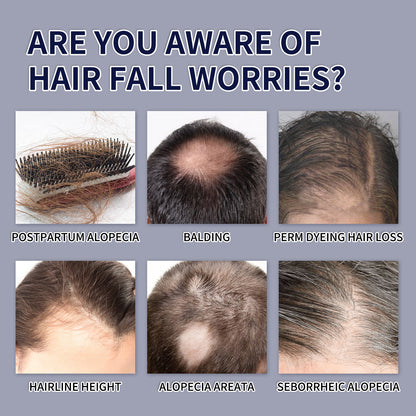 Rianmond Hair Growth Spray
