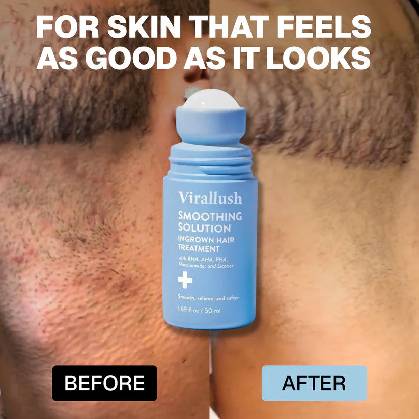 Rianmond: Smoothing Solution For Ingrown Hairs