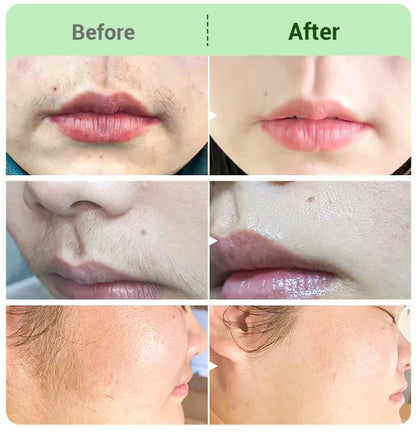 🌎Ends Today: 70% OFF!     Hair Removal Cream for All Women & Men