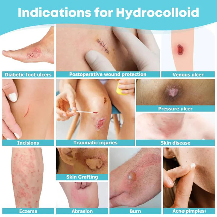 Medical-Grade Hydrocolloid Acne Roll