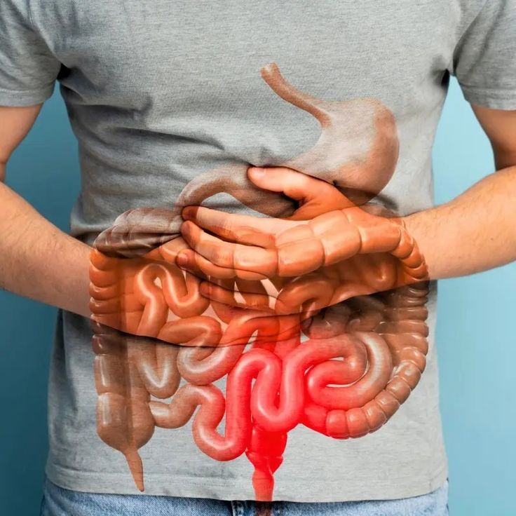 GUT SUPPORT CAPSULE
