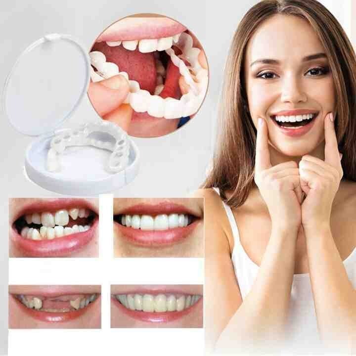🔥 Last Day 49% OFF - Latest👨‍⚕Adjustable Snap-On Dentures😁