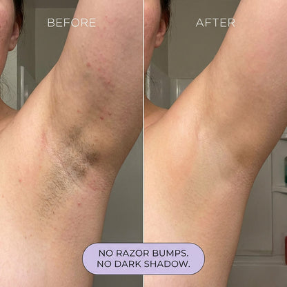 Hair Removal Cream for All Women & Men