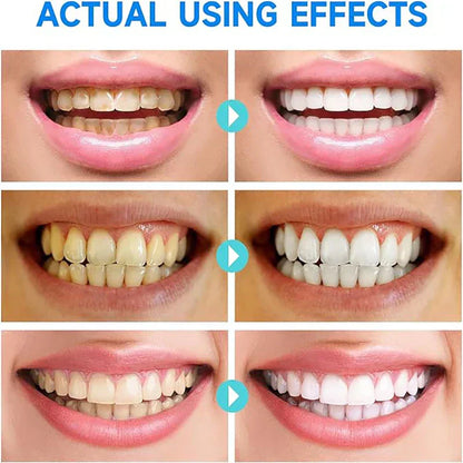 #1 Niacinamide Whitening Toothpaste
