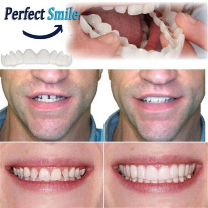 🔥 Last Day 49% OFF - Latest👨‍⚕Adjustable Snap-On Dentures😁