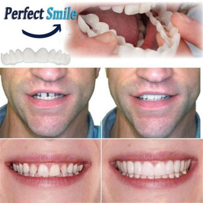 🔥 Last Day 49% OFF - Latest👨‍⚕Adjustable Snap-On Dentures😁