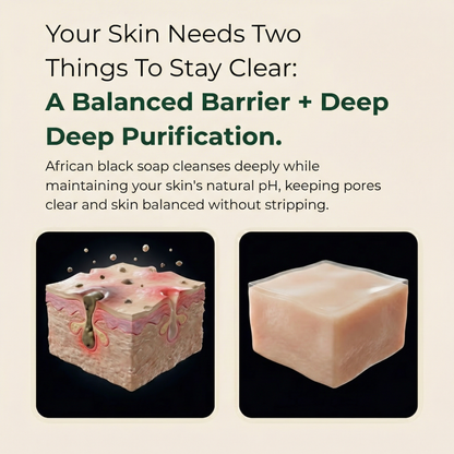 Pure Nilotica Shea Butter by Rianmond™